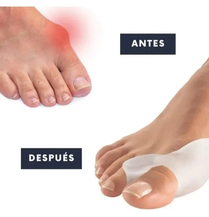 CORRECTOR DE JUANETES